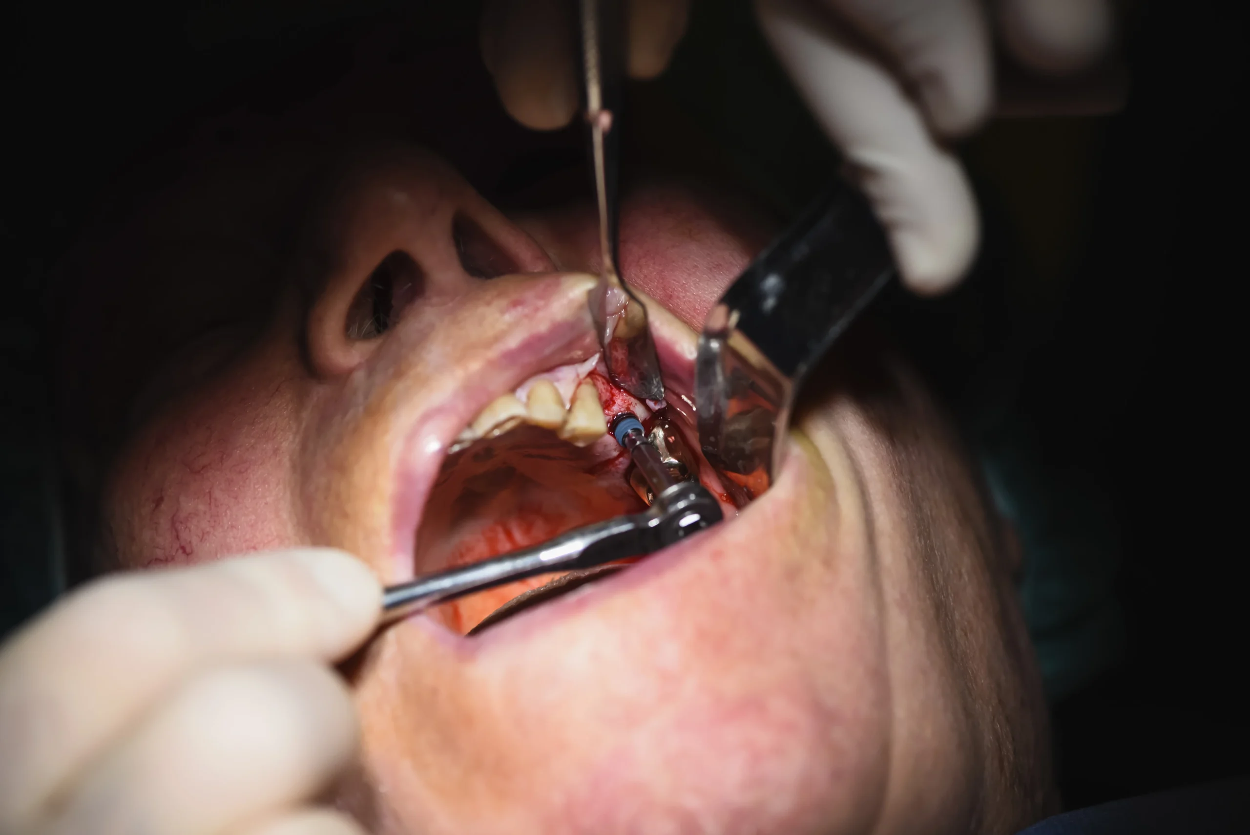 dental-surgery-2024-12-06-06-20-45-utc