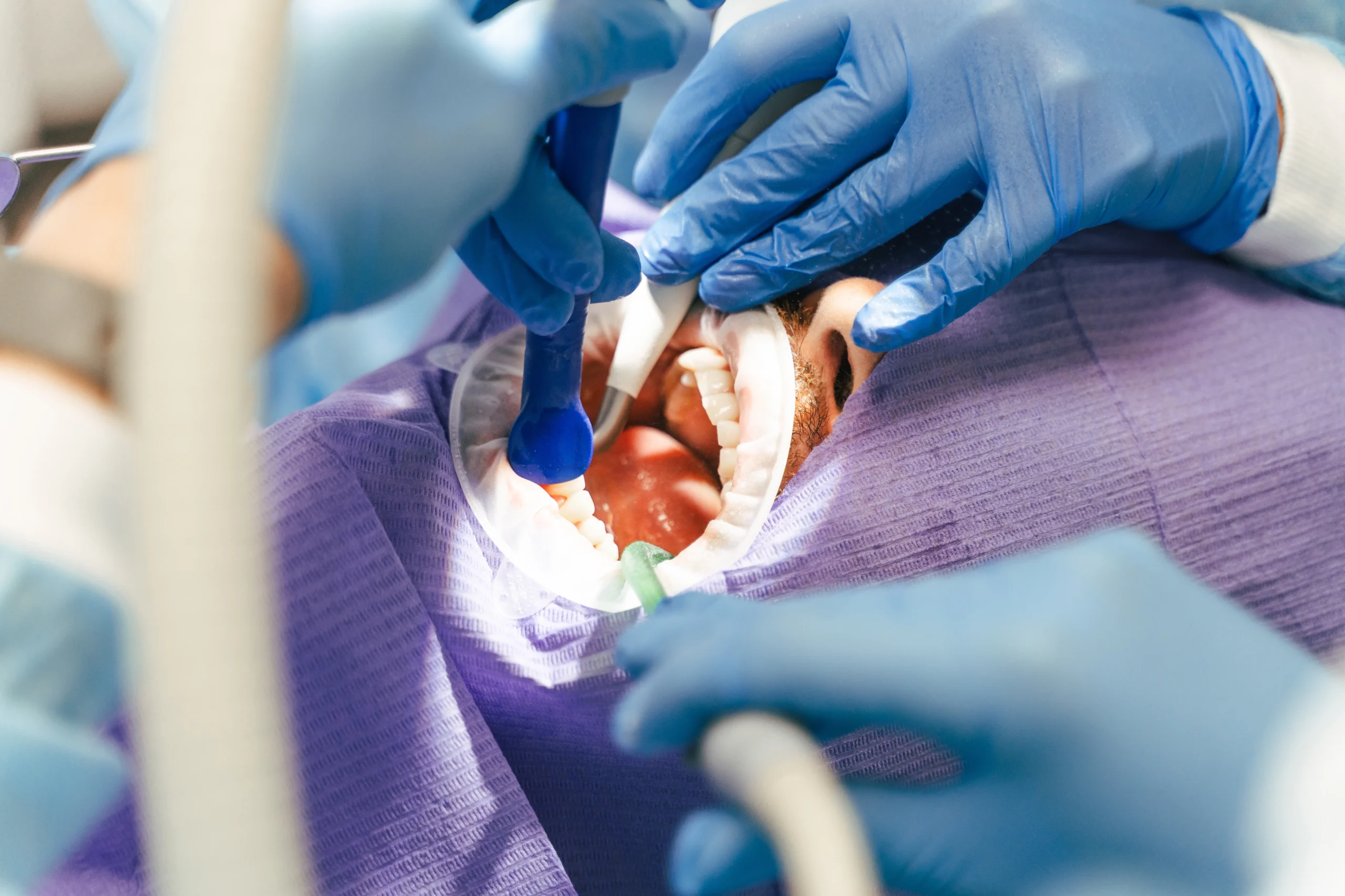 patient-with-open-mouth-selective-focus-on-hands-2025-02-20-09-53-22-utc