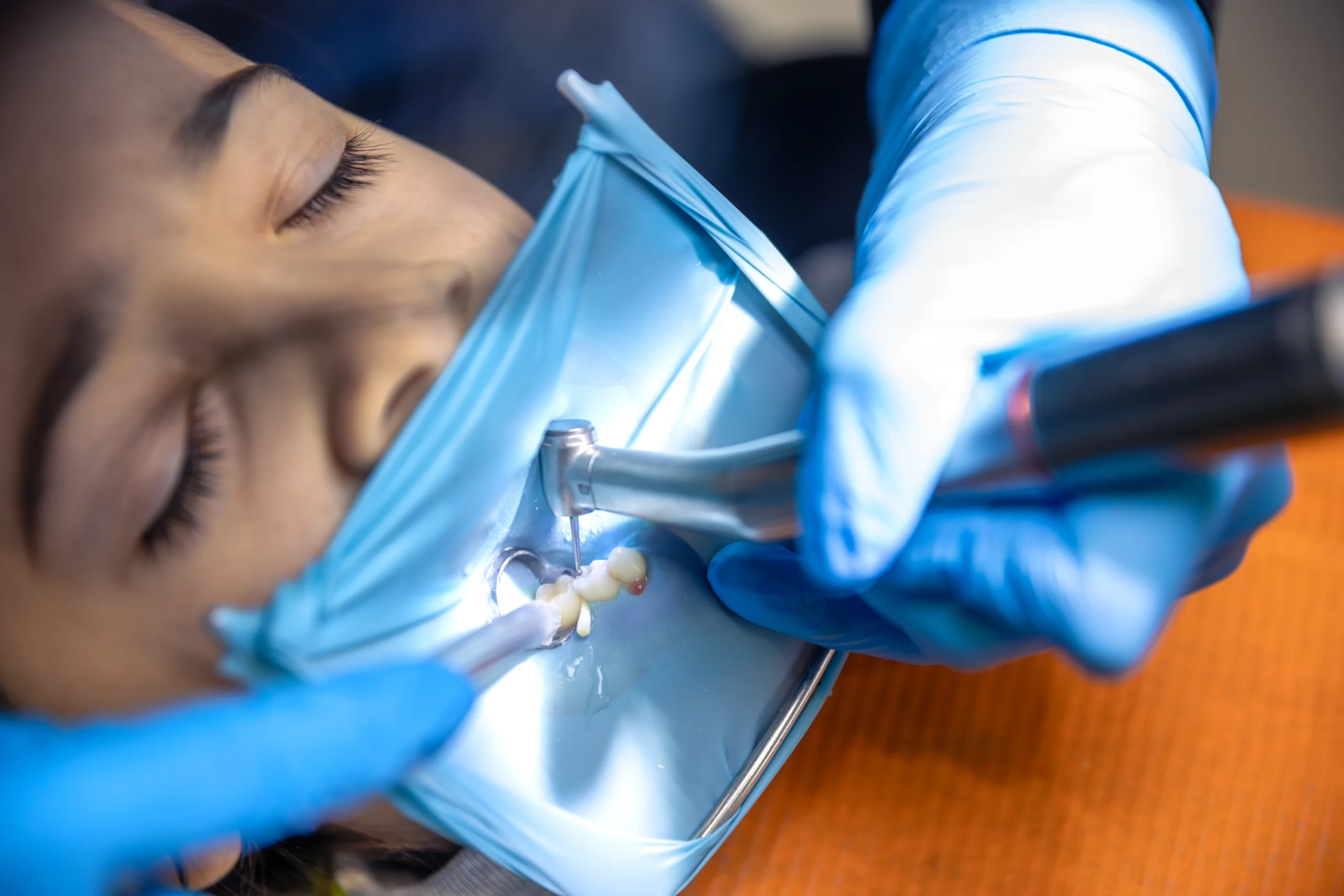 the-dentist-treats-the-child-s-tooth-using-a-rubbe-2025-03-18-14-08-16-utc